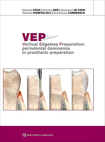 Portada del libro 9788874922130 VEP Vertical Edgeless Preparation: Periodontal Dominance in Prosthetic Preparation