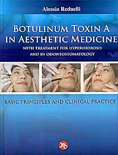 Portada del libro 9788890503313 Botulinum Toxin a in Aesthetic Medicine. with Treatment for Hyperhidrosis and in Odontostomatology