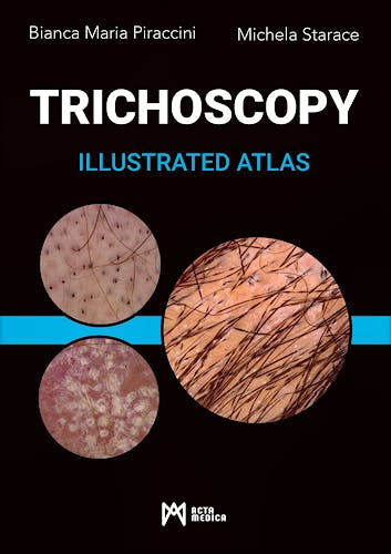 Portada del libro 9788897438885 Trichoscopy. Illustrated Atlas
