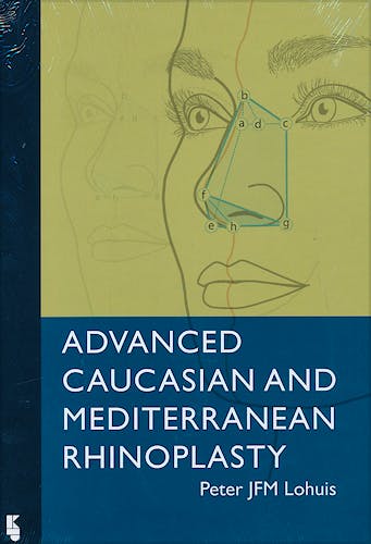 Portada del libro 9789062992386 Advanced Caucasian and Mediterranean Rhinoplasty