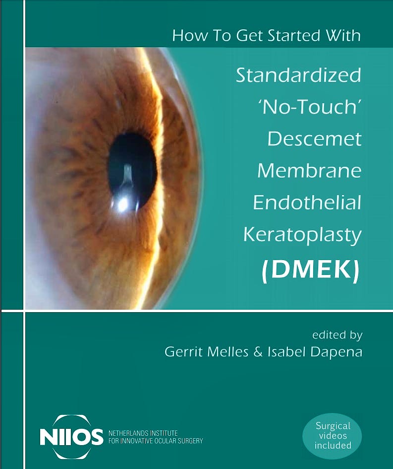 Portada del libro 9789088902772 How to Get Started with Standardized No-Touch Descemet Membrane Endothelial Keratoplasty (DMEK)