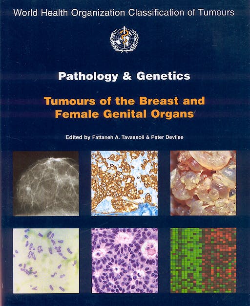 Portada del libro 9789283224129 Pathology and Genetics. Tumours of the Breast and Female Genital Organs (World Health Organization Classification of Tumours)