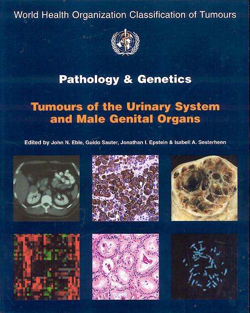 Portada del libro 9789283224150 Pathology and Genetics Tumours of the Urinary System and Male Genital Organs