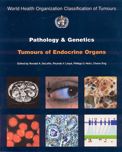 Portada del libro 9789283224167 Pathology and Genetics of Tumours of Endocrine Organs