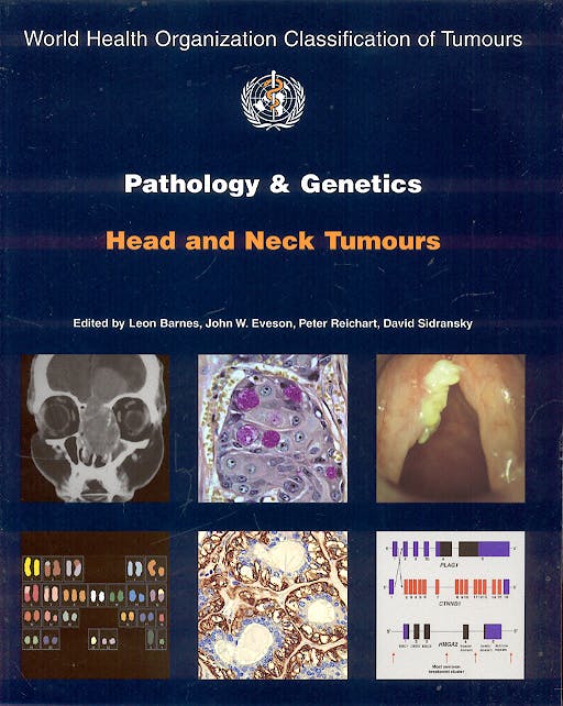 Portada del libro 9789283224174 Pathology and Genetics of Head and Neck Tumours