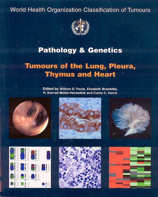 Portada del libro 9789283224181 Pathology & Genetics. Tumours of the Lung, Pleura, Thymus and Heart