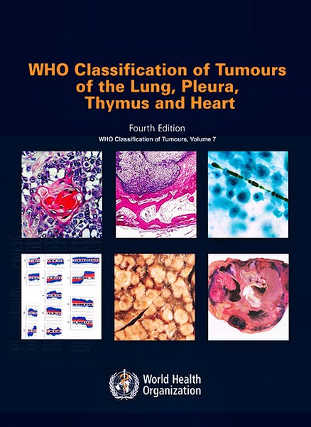Portada del libro 9789283224365 WHO Classification of Tumours of the Lung, Pleura, Thymus and Heart (WHO Classification of Tumours, Vol. 7)