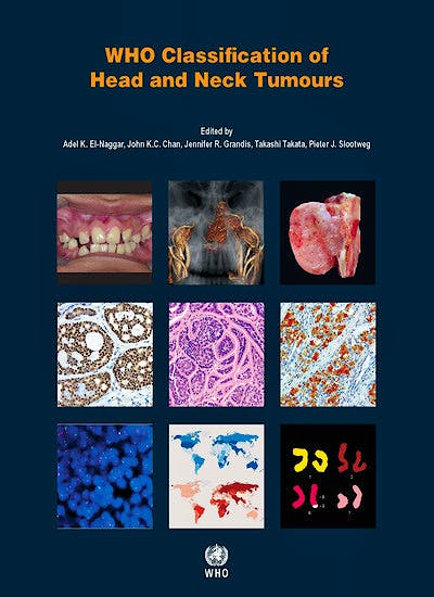 Portada del libro 9789283224389 WHO Classification of Head and Neck Tumours (WHO Classification of Tumours, Vol. 9)