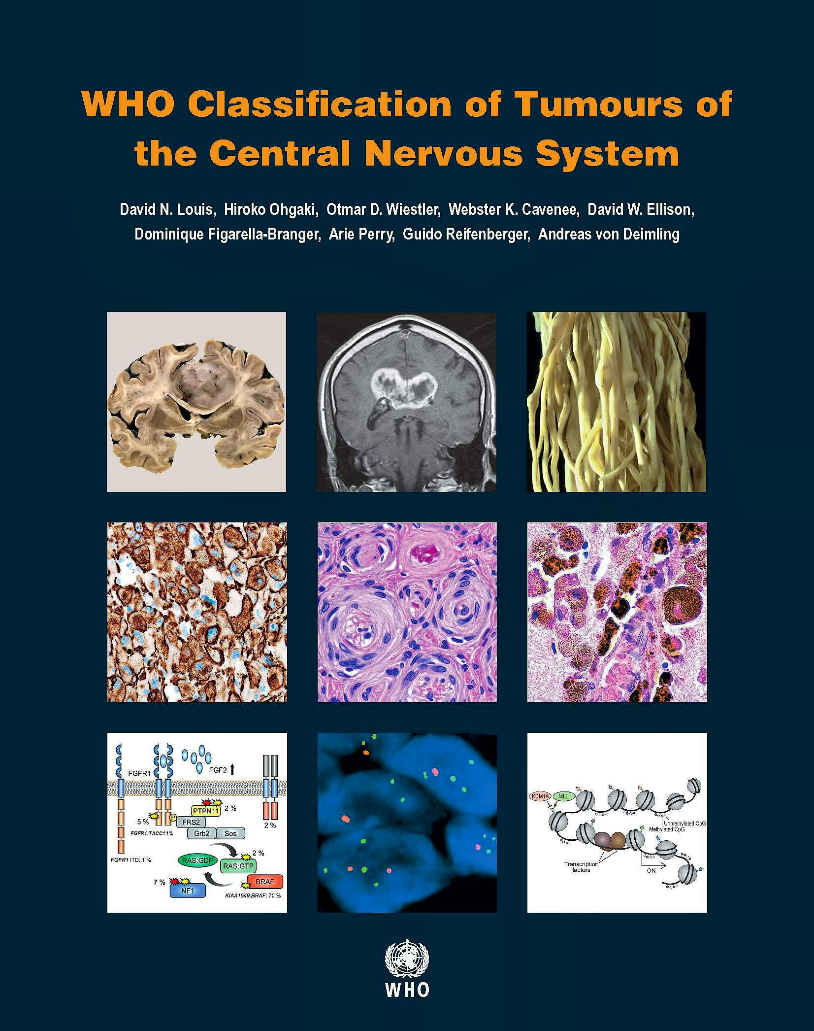 Portada del libro 9789283244929 WHO Classification of Tumours of the Central Nervous System (WHO Classification of Tumours, Vol. 1)