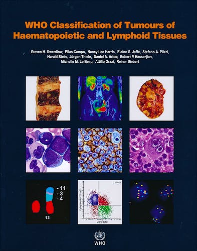 Portada del libro 9789283244943 WHO Classification of Tumours of Haematopoietic and Lymphoid Tissues (WHO Classification of Tumours, Vol. 2)