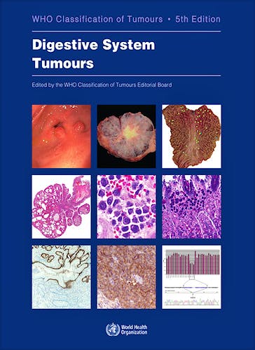 Portada del libro 9789283244998 WHO Classification of Tumours: Digestive System Tumours (WHO Classification of Tumours, Vol. 1)