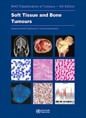 Portada del libro 9789283245025 WHO Classification of Tumours: Soft Tissue and Bone Tumours (WHO Classification of Tumours, Vol. 3)