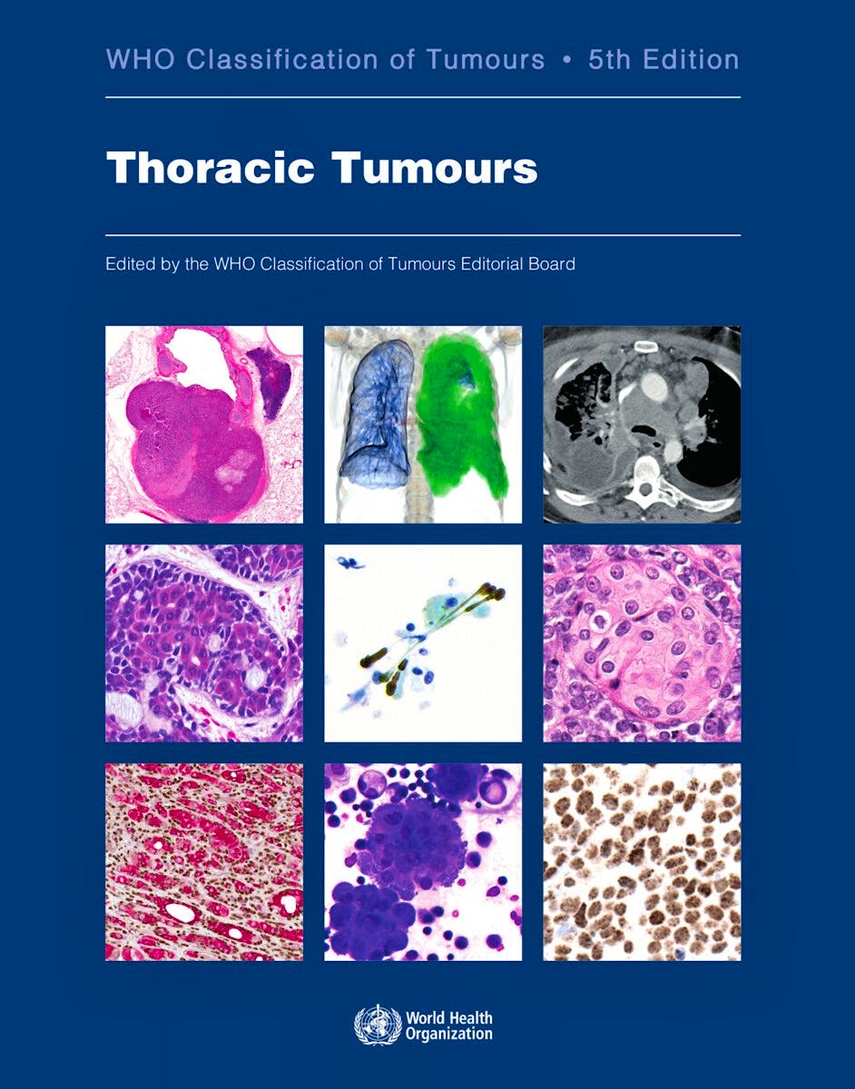 WHO Classification Of Tumours. Thoracic Tumours (WHO Classification Of ...