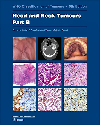 Portada del libro 9789283245148 WHO Classification of Tumours: Head and Neck. Part A and Part B (WHO Classification of Tumours, Vol. 9), 2 Volume Set