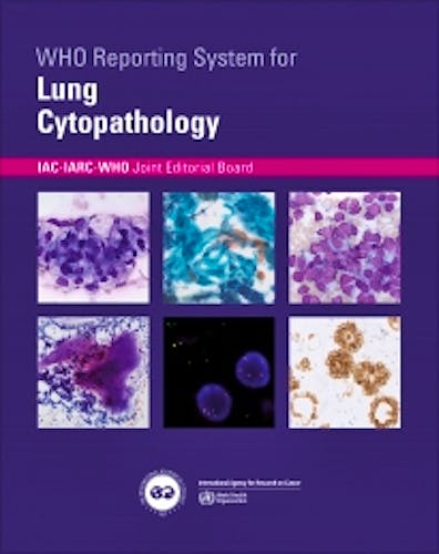 Portada del libro 9789283245162 WHO Reporting System for Lung Cytopathology (IAC-IARC-WHO Cytopathology Reporting Systems, Vol. 1)