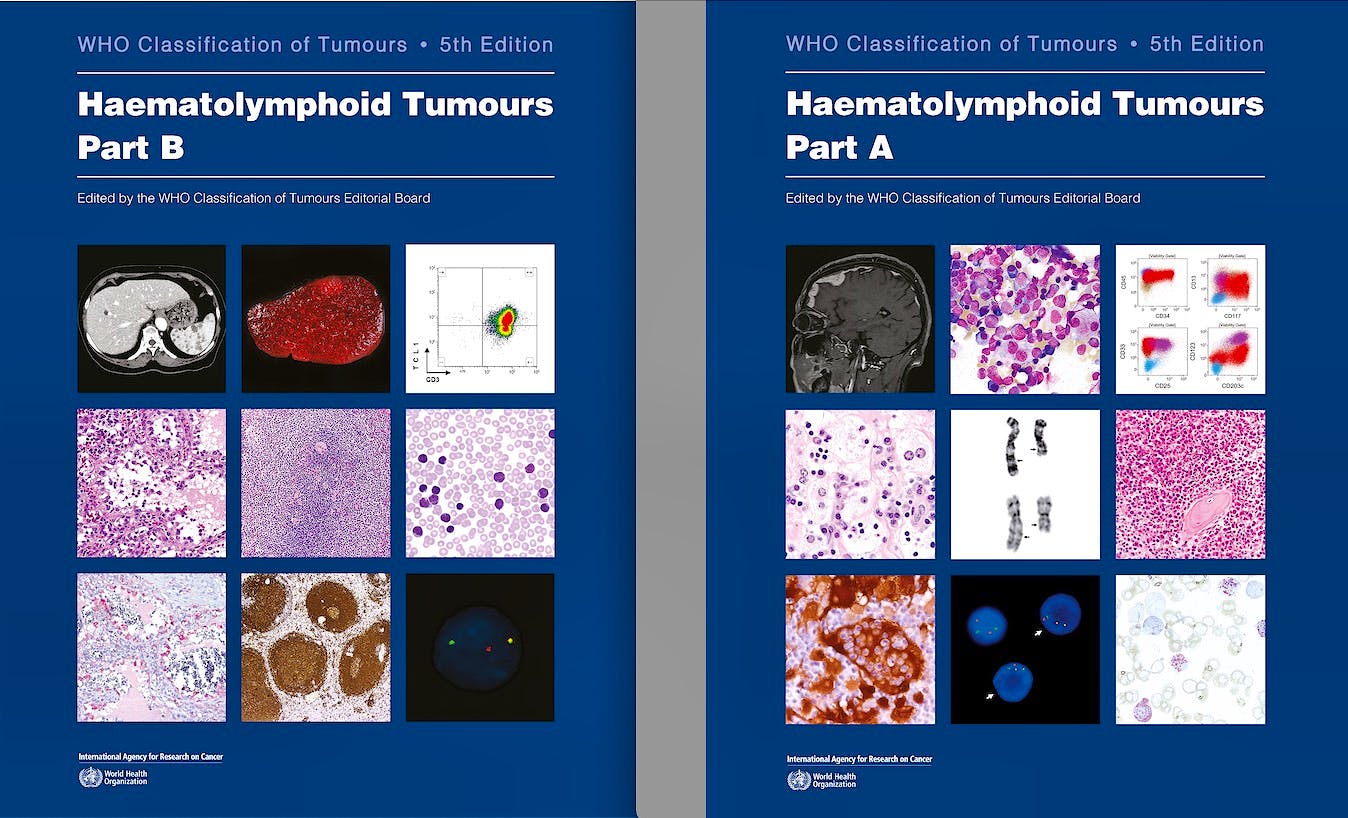 WHO Classification Of Tumours: Haematolymphoid Tumours. Part A And Part ...