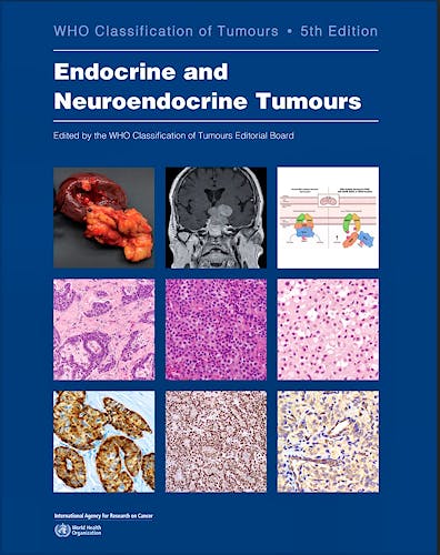 Portada del libro 9789283245247 WHO Classification of Tumours: Endocrine and Neuroendocrine Tumours (WHO Classification of Tumours, Vol. 10)