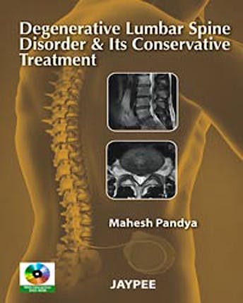 Portada del libro 9789350250020 Degenerative Lumbar Spine Disorder and Its Conservative Treatment