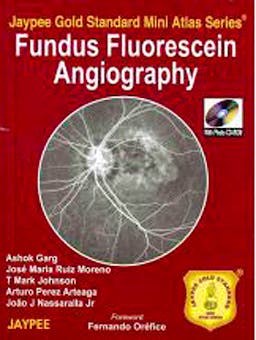 Portada del libro 9789350250051 Fundus Flourescein Angiography (Jaypee Gold Standard Mini Atlas Series)