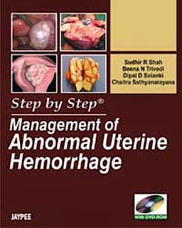 Portada del libro 9789350250266 Step by Step Management of Abnormal Uterine Hemorrhage + Dvd-Rom