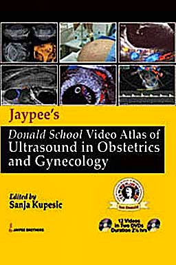 Portada del libro 9789350250969 Video Atlas Ultrasound Obstetrics and Gynecology + Dvd