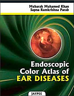 Portada del libro 9789350251669 Endoscopic Color Atlas of Ear Diseases