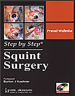 Portada del libro 9789350251966 Step by Step Squint Surgery + Cd