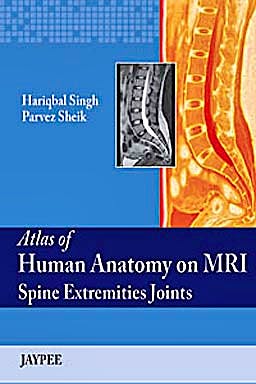 Portada del libro 9789350252338 Atlas of Human Anatomy on Mri Spine Extremities Joints