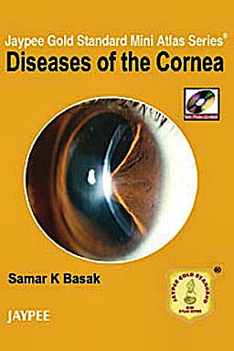 Portada del libro 9789350252611 Diseases of the Cornea (Jaypee Gold Standard Mini Atlas Series)