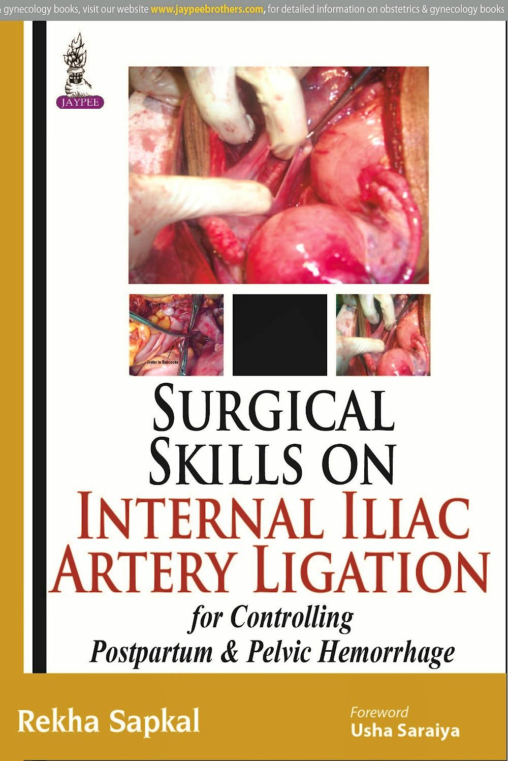 Portada del libro 9789350253786 Surgical Skills on Internal Iliac Artery Ligation for Controlling Postpartum and Pelvic Hemorrhage