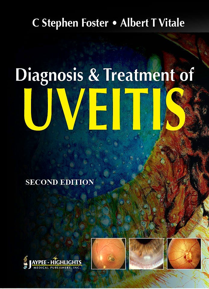Portada del libro 9789350255728 Diagnosis and Treatment of Uveitis
