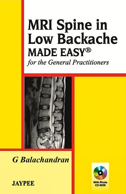 Portada del libro 9789350257142 Mri Spine in Low Backache Made Easy for the General Practitioners + Cd-Rom