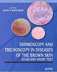 Portada del libro 9789350257944 Dermoscopy and Trichoscopy in Diseases of the Brown Skin. Atlas and Short Text