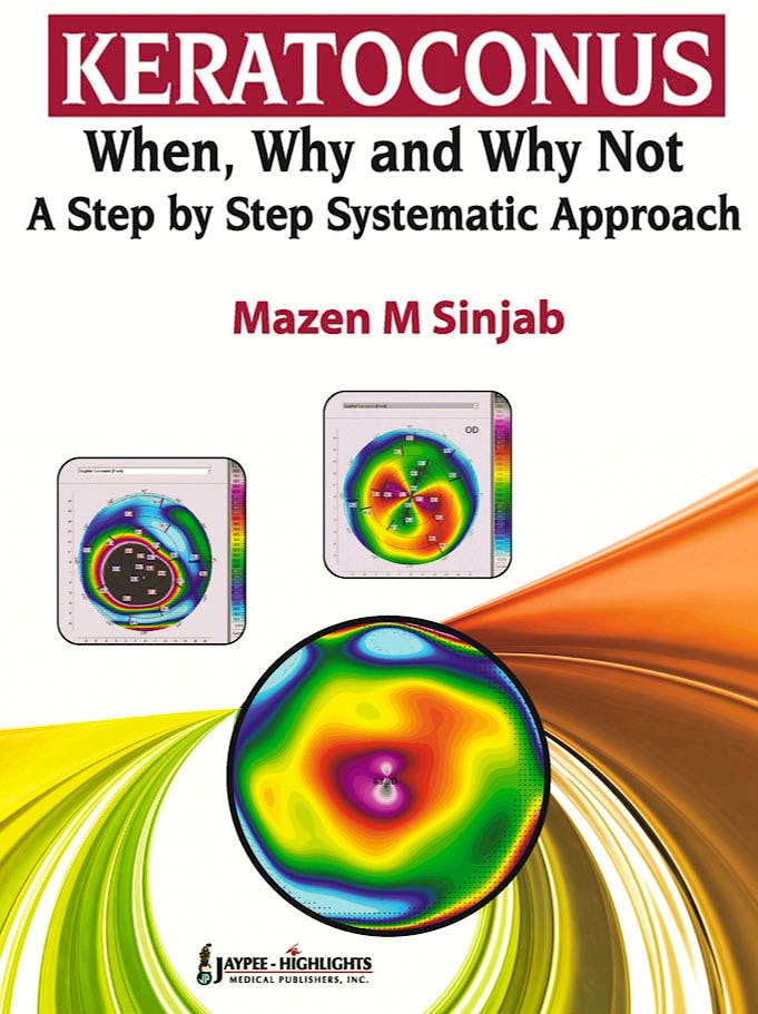 Portada del libro 9789350259221 Keratoconus. When, Why and Why Not. a Step by Step Systematic Approach