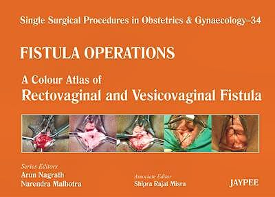 Portada del libro 9789350902929 Single Surgical Procedures in Obstetrics and Gynaecology, Vol. 34: Fistula Operations. a Colour Atlas of Rectovaginal and Vesicovaginal Fistula
