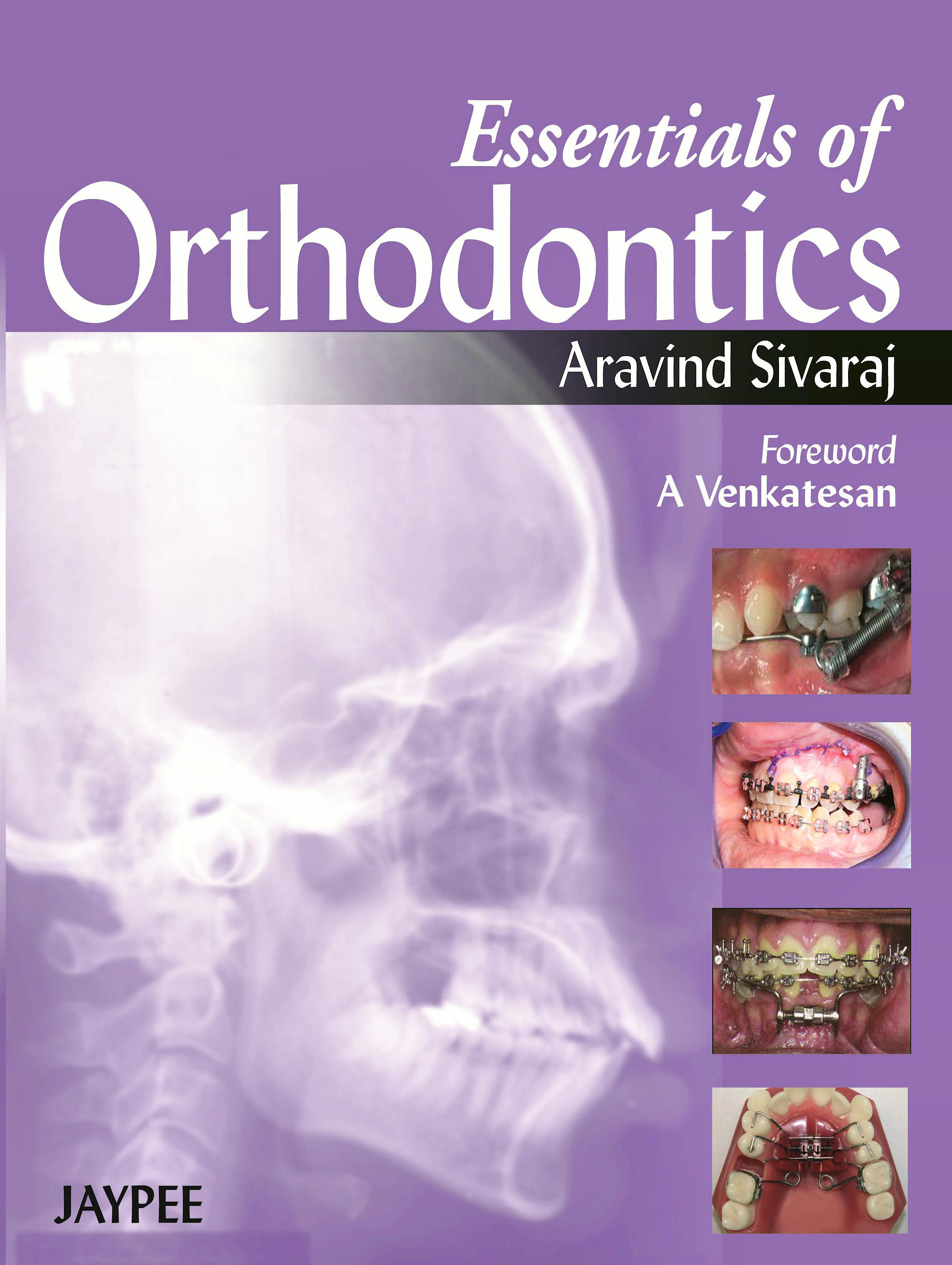 Portada del libro 9789350903292 Essentials of Orthodontics