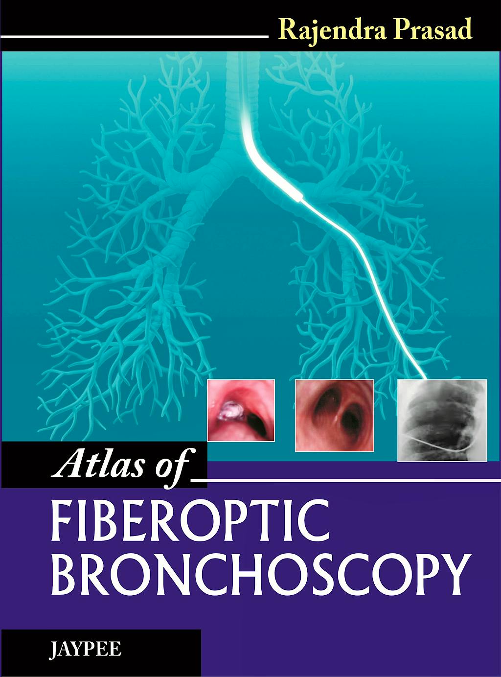 Portada del libro 9789350903407 Atlas of Fiberoptic Bronchoscopy