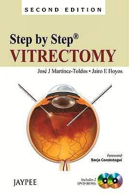 Portada del libro 9789350903544 Step by Step Vitrectomy + 2 Dvd-Roms
