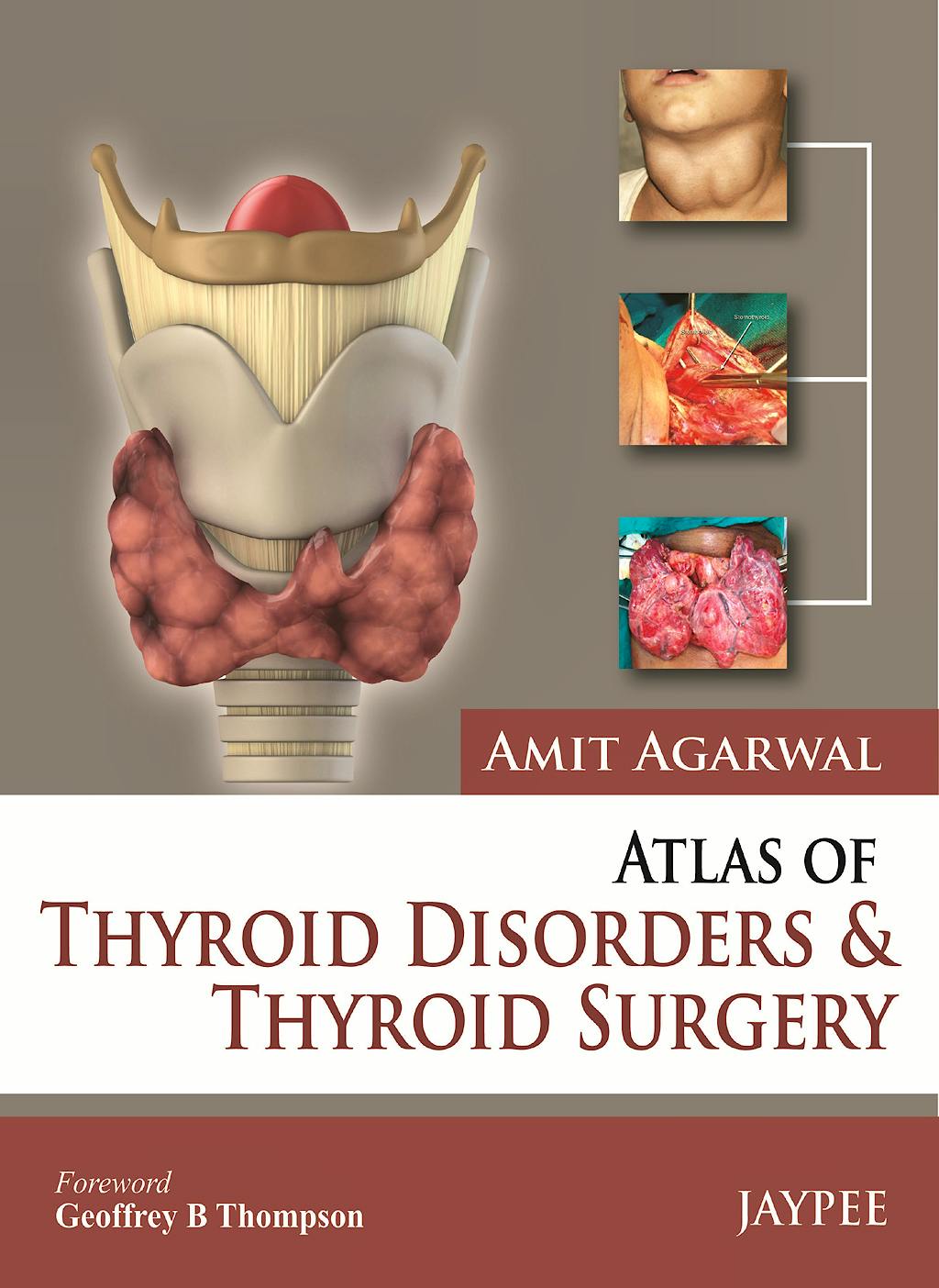 Portada del libro 9789350903988 Atlas of Thyroid Disorders and Thyroid Surgery