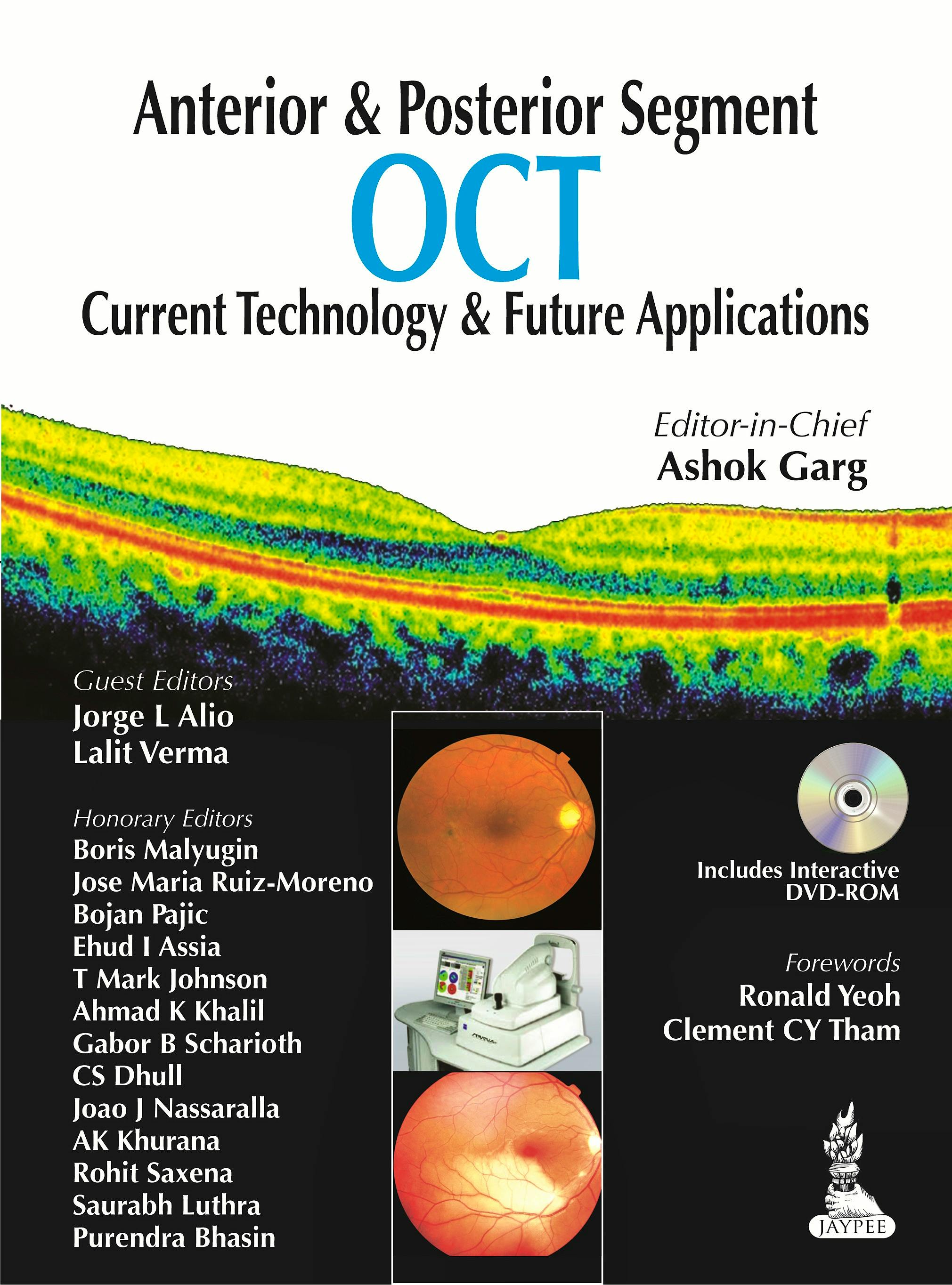 Portada del libro 9789350909782 Anterior and Posterior Segment Oct. Current Technology and Future Applications + Dvd-Rom