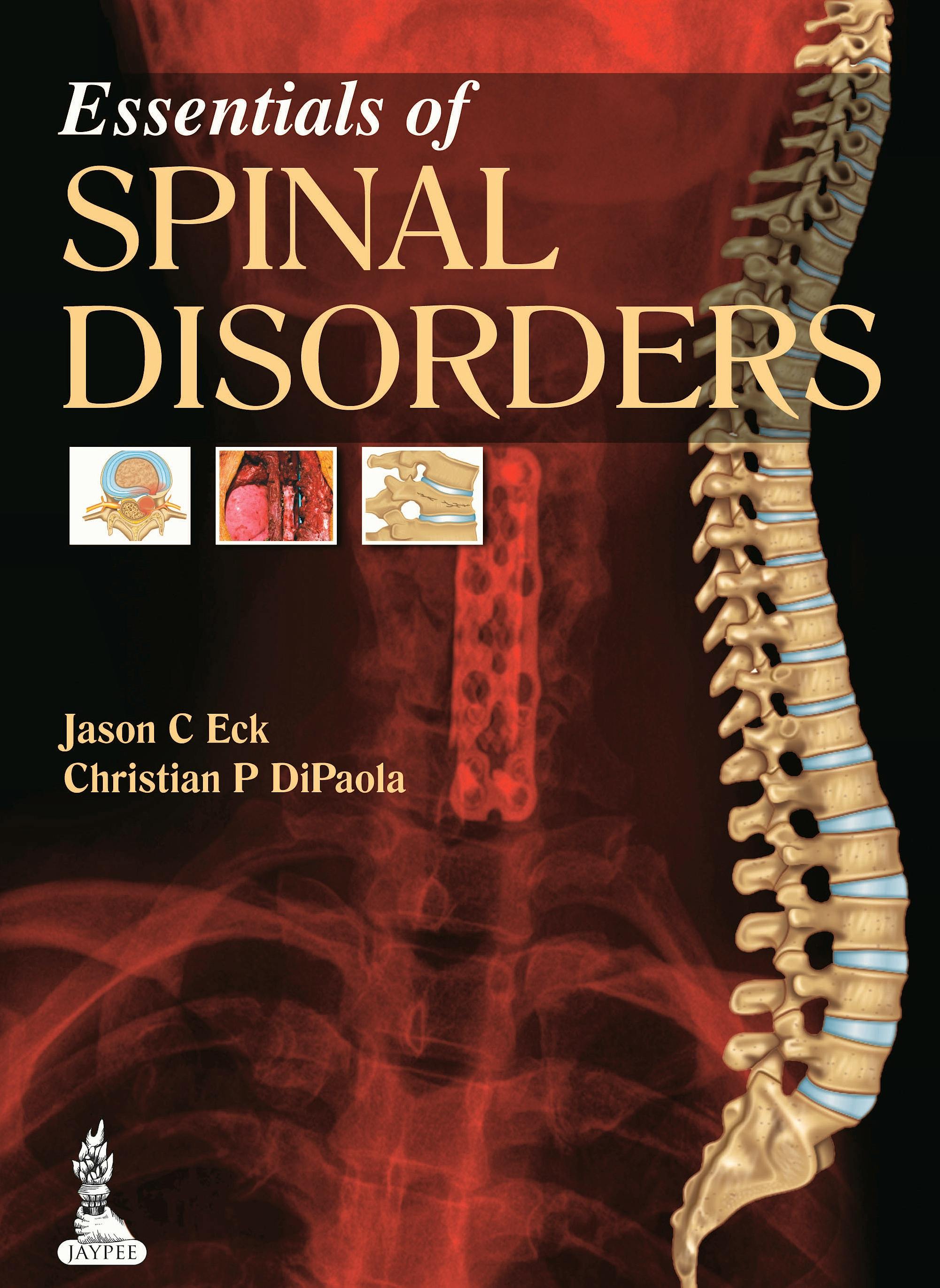 Portada del libro 9789350909836 Essentials of Spinal Disorders