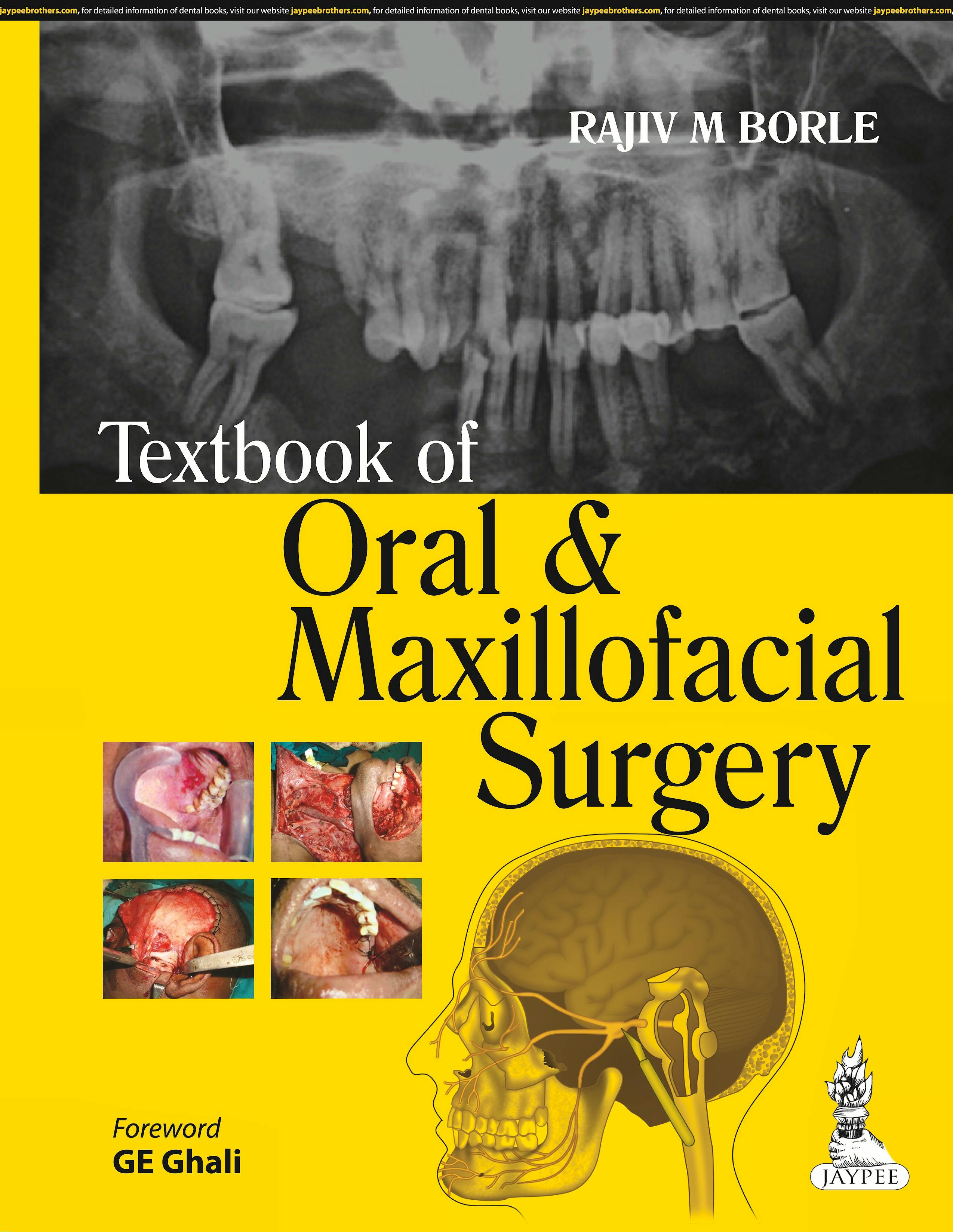 Portada del libro 9789351520092 Textbook of Oral and Maxillofacial Surgery