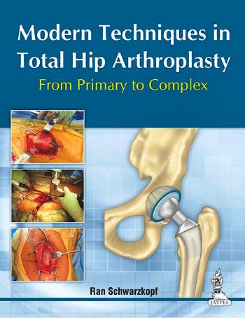 Portada del libro 9789351520825 Modern Techniques in Total Hip Arthroplasty. from Primary to Complex