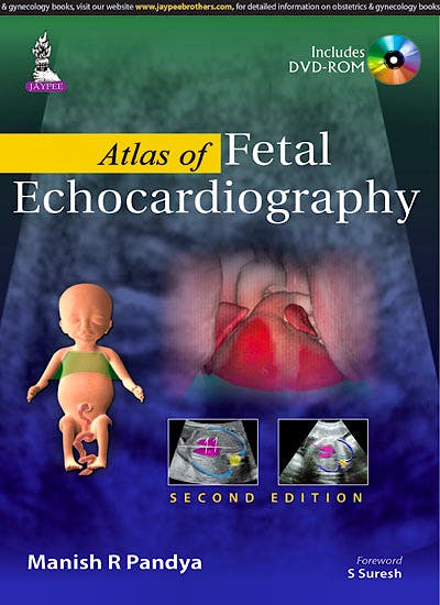 Portada del libro 9789351524762 Atlas of Fetal Echocardiography + Dvd-Rom