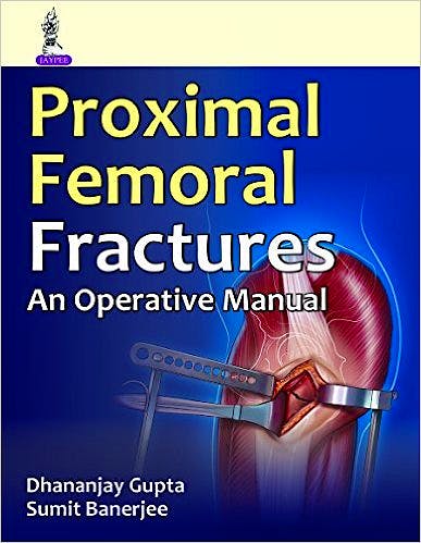 Portada del libro 9789351524854 Proximal Femoral Fractures. An Operative Manual
