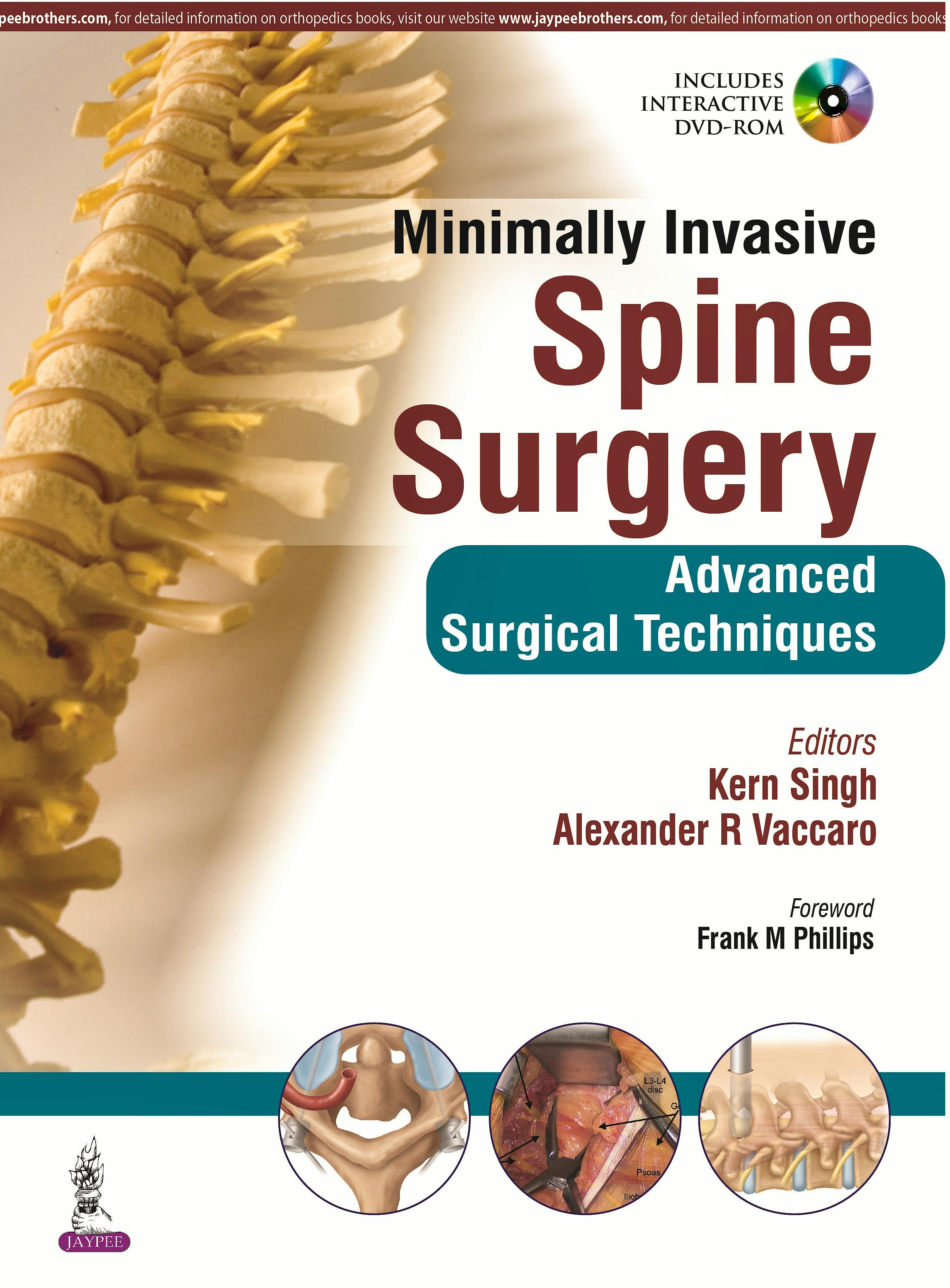 Portada del libro 9789351524939 Minimally Invasive Spine Surgery. Advanced Surgical Techniques + Dvd-Rom