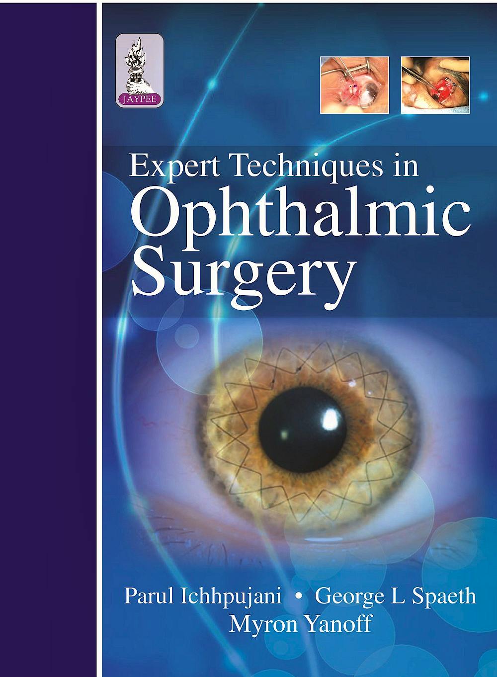 Portada del libro 9789351525004 Expert Techniques in Ophthalmic Surgery