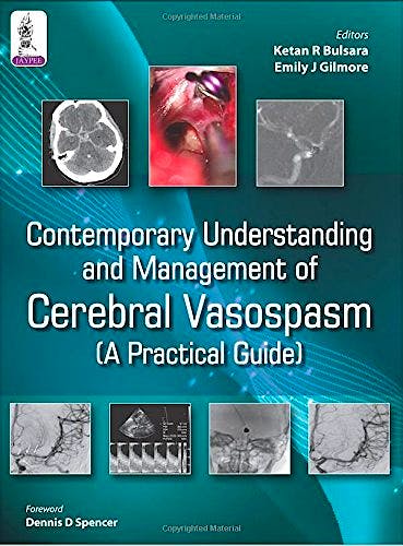 Portada del libro 9789351525608 Contemporary Understanding and Management of Cerebral Vasospasm. A Practical Guide