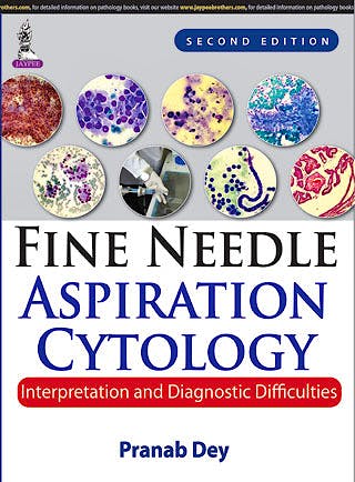 Portada del libro 9789351526087 Fine Needle Aspiration Cytology. Interpretation and Diagnostic Difficulties