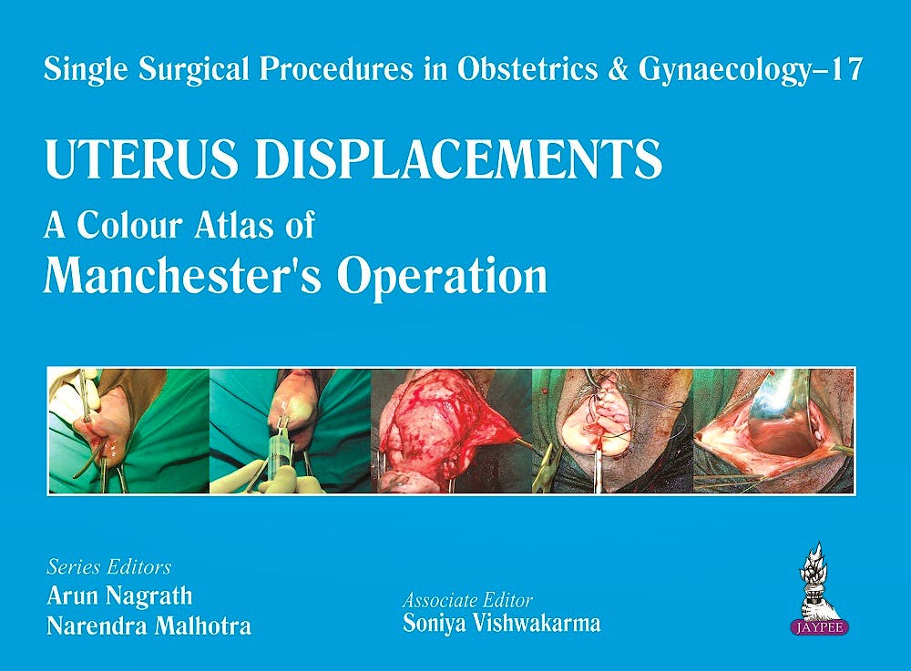 Portada del libro 9789351526117 Single Surgical Procedures in Obstetrics and Gynaecology 17: Uterus Displacements